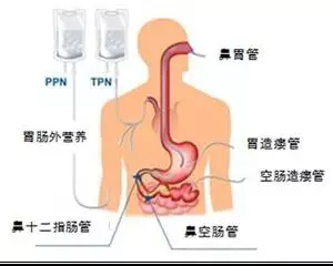 麻醉耗材