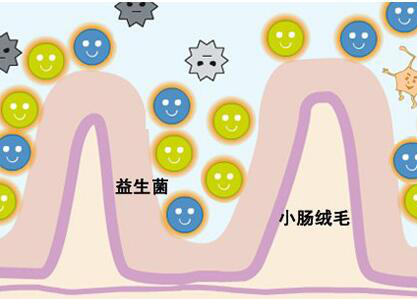 子弹头空肠营养管